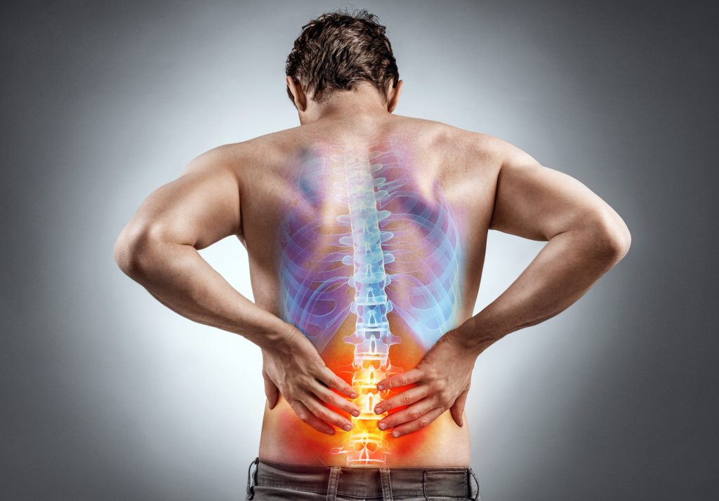 bolesť bedrového kĺbu-chrbtica
